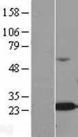 ALKBH7 Protein (Over-Expression Lysate Myc-DDK (Flag))