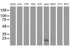 EFNA2 / Ephrin A2 Antibody (clone OTI2B7)