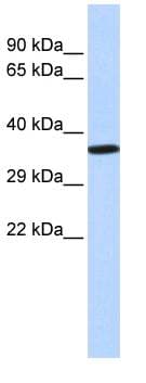 NKX2-2 Antibody (N-Terminus)