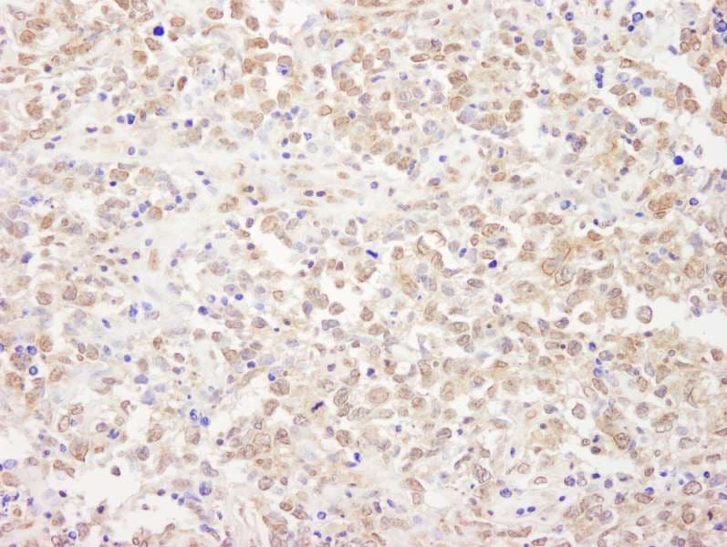 NRSF / REST Antibody (aa800-850)