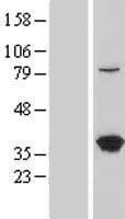 LZTFL1 Protein (Over-Expression Lysate Myc-DDK (Flag))