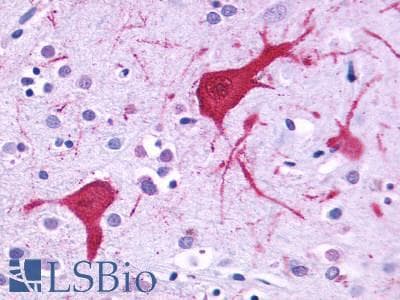 PathPlus™ Polyclonal Rabbit anti-Human CCKBR / Cckb Antibody (Cytoplasmic Domain, IHC)