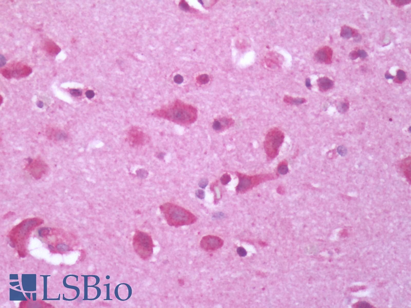 PathPlus™ Polyclonal Rabbit anti-Human GPR34 Antibody (Cytoplasmic Domain, IHC)