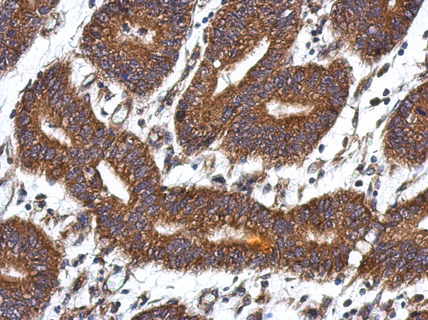 QDPR / DHPR Antibody