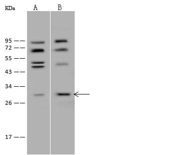 Polyclonal Rabbit anti-Human HDHD2 Antibody (IHC, WB)