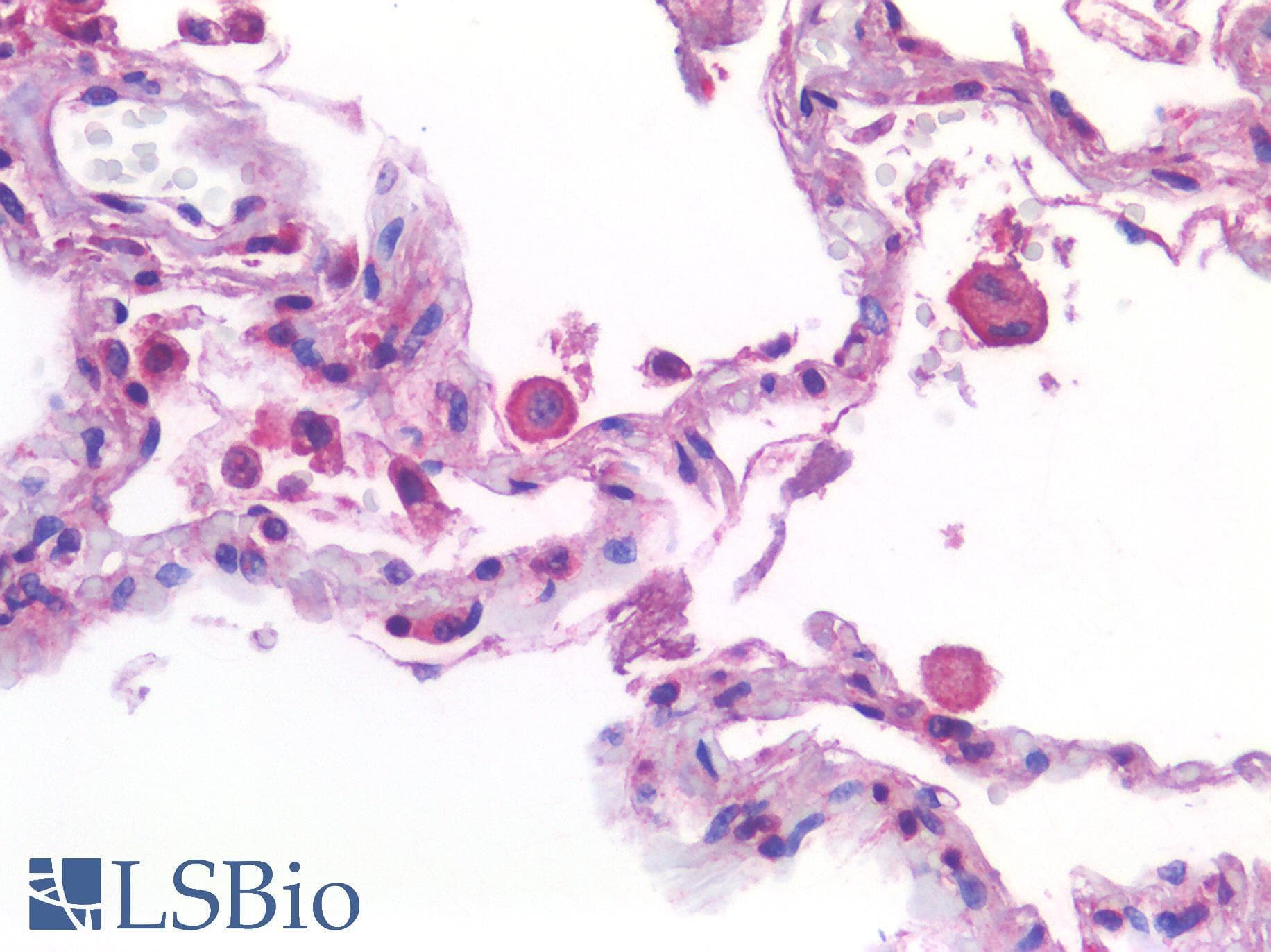PathPlus™ ACE2 / ACE-2 Antibody (aa684-733)