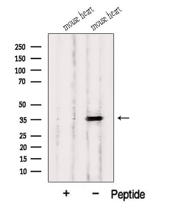 Polyclonal Rabbit anti-Human HIBADH Antibody (IF, WB)