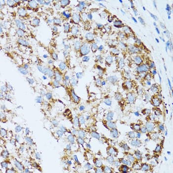 Polyclonal Rabbit anti-Human CLDN11 / Claudin 11 Antibody (IHC, IF, WB)