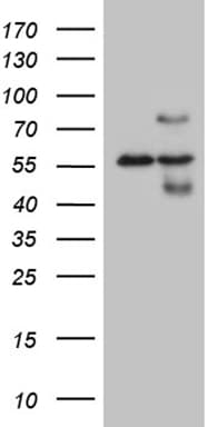 HABP2 Antibody (aa33-330, clone OTI8D6, Carrier-free)