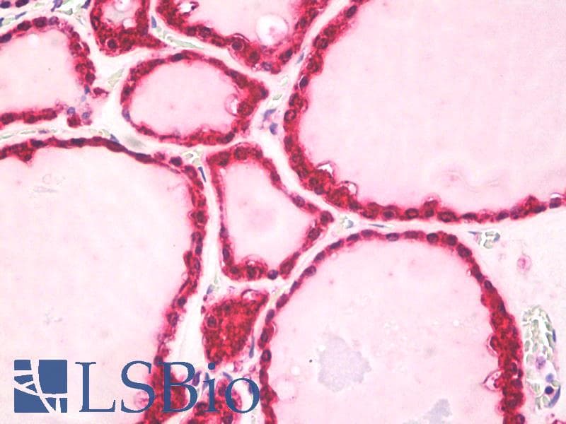 IHC-plus™ Polyclonal Rabbit anti-Human ARRB2 / Beta Arrestin 2 Antibody (aa23-40, IHC, WB)