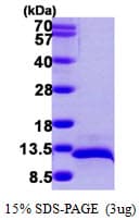Human CCL14 Protein (Recombinant His)