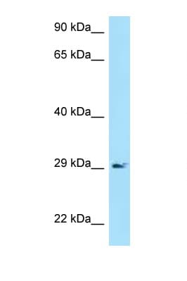 CD79A / CD79 Alpha Antibody (aa71-120)