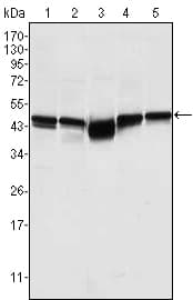 GSK3B / GSK3 Beta Antibody (clone 3D10)