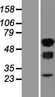 WTAP Protein (Over-Expression Lysate Myc-DDK (Flag))