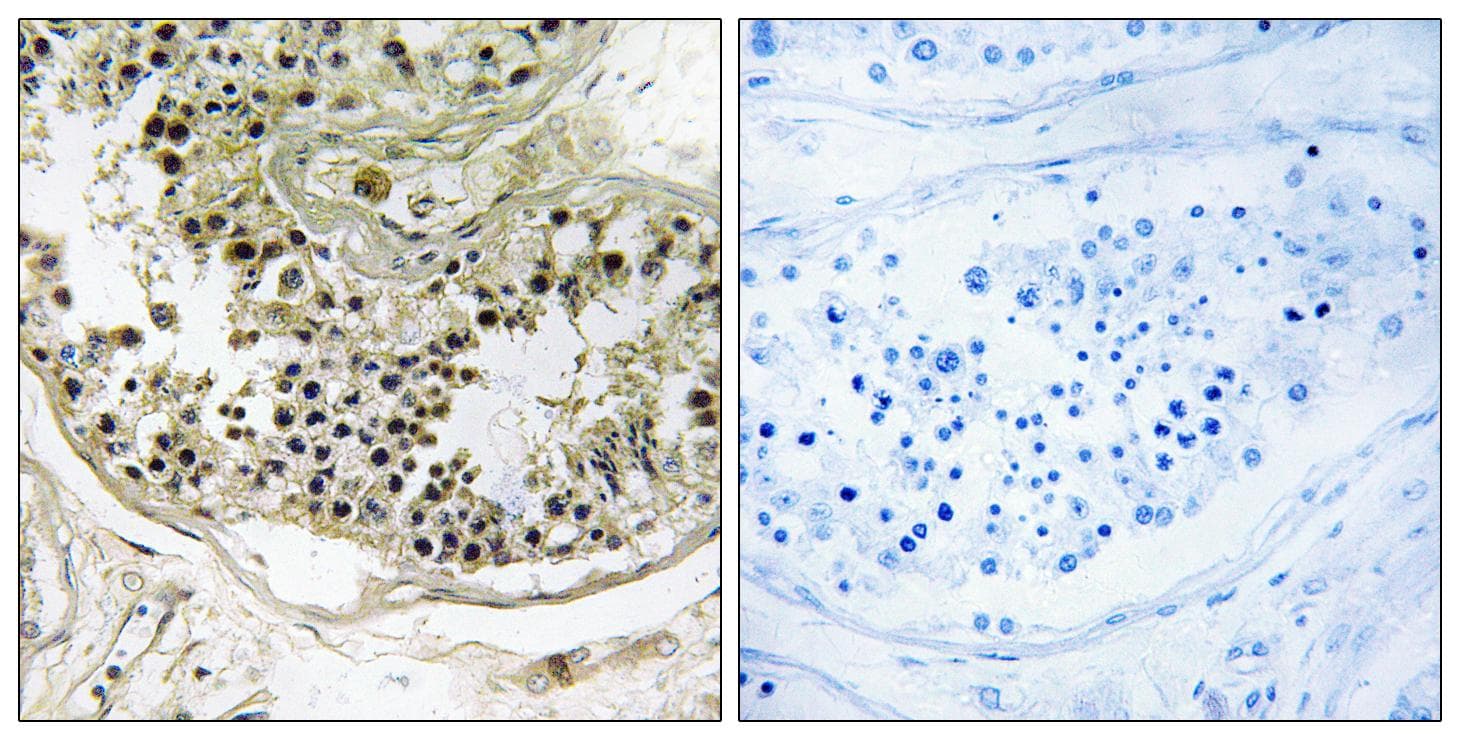 DYNLRB2 Antibody