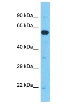RAI2 Antibody (aa410-459)