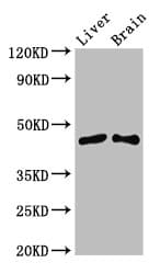 Polyclonal Rabbit anti-Human SIRT3 / Sirtuin 3 Antibody (IF, WB)