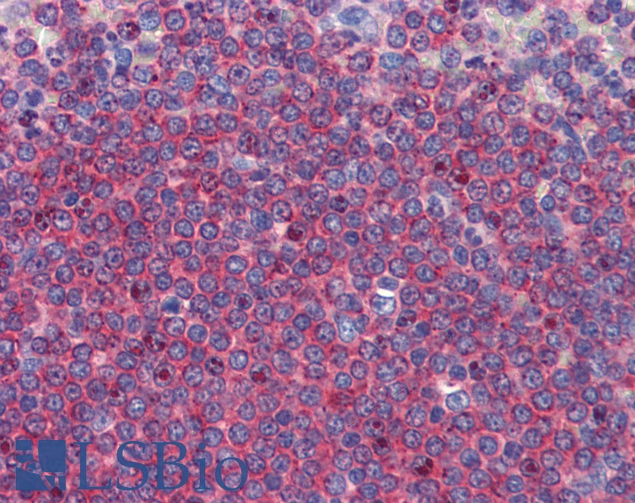IHC-plus™ ALDH5A1 Antibody