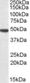 IHC-plus™ Polyclonal Goat anti-Human SEC61A1 / SEC61 Antibody (aa463-476, IHC, WB)