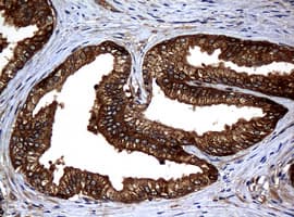 NME1 / NM23 Antibody (clone OTI4H2)