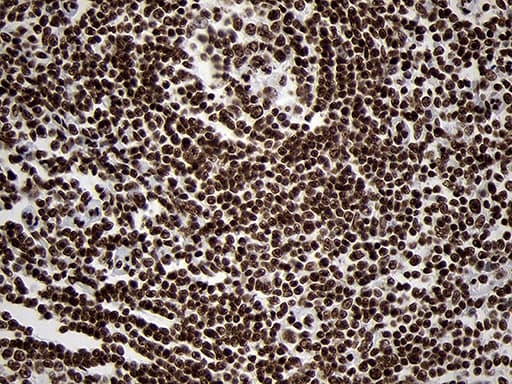 SMC1A / SMC1 Antibody (aa889-1016, clone OTI3G4, Carrier-free)