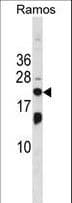 Polyclonal Rabbit anti-Human HEM45 / ISG20 Antibody (aa29-58, WB)