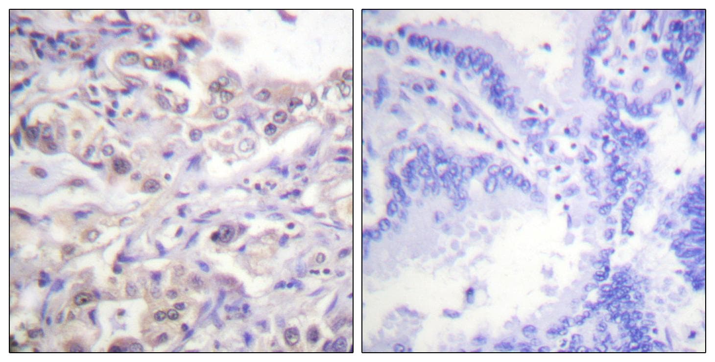 HNRNPD / AUF1 Antibody (phospho-Ser83)
