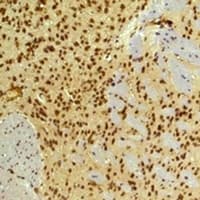Monoclonal Mouse anti-Mouse ARNT / HIF-1-Beta Antibody (IHC, WB)