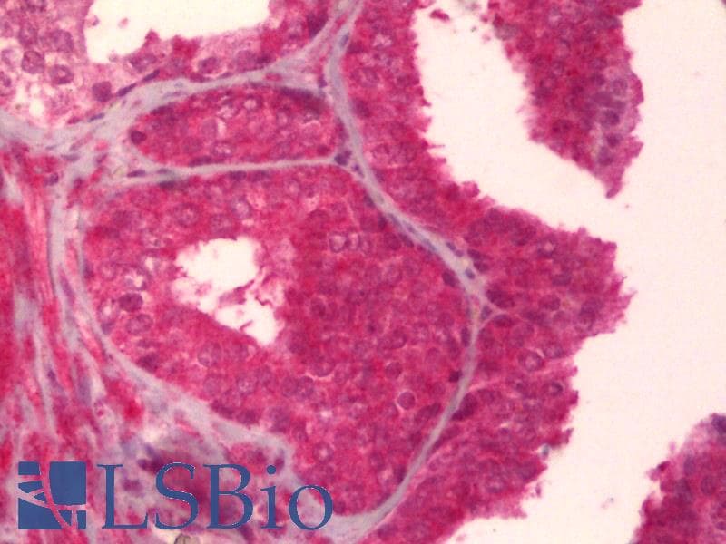 IHC-plus™ TIE1 / TIE Antibody (clone 1G10)