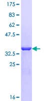 Human ACYP2 Protein (Recombinant GST)