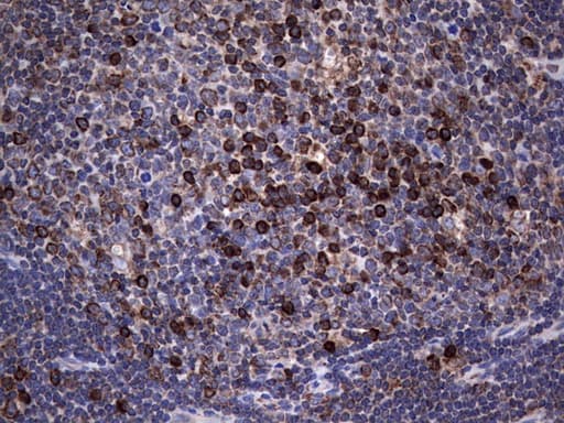 MTDH / Metadherin Antibody (aa70-582, clone OTI1B6)