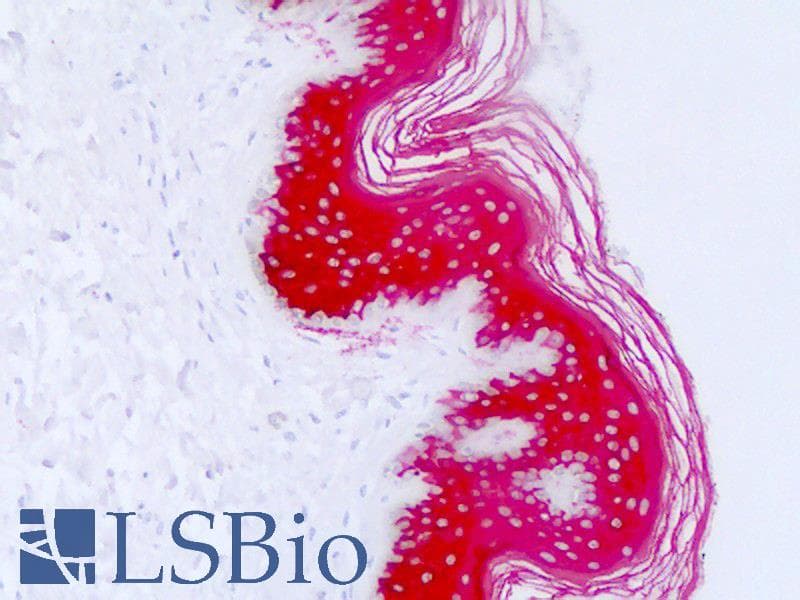 PathPlus™ KRT10 / CK10 / Cytokeratin 10 Antibody (clone DE-K10, Concentrated)