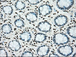 TYRO3 Antibody (clone OTI4C8)