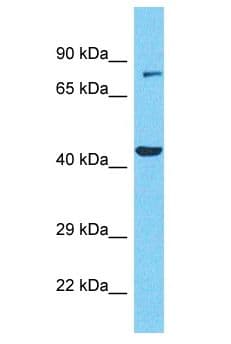 CCDC85C Antibody (aa63-112)