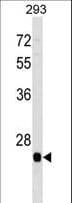BTG4 Antibody (aa142-169)