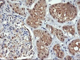 FBXO21 Antibody (clone OTI2C7)