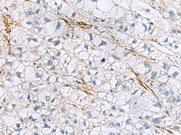 TAGLN3 / Neuronal Protein 22 Antibody