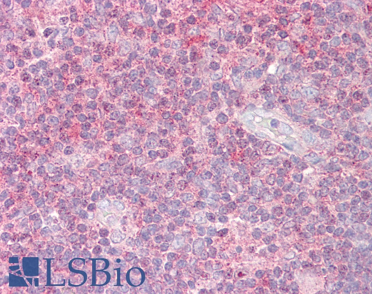 IHC-plus™ SENP1 Antibody (aa1-50)