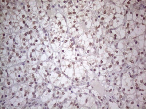 TLK2 Antibody (aa1-296, clone OTI3E10)