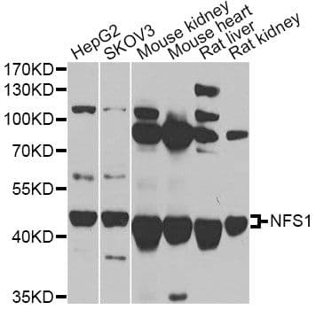 Polyclonal Rabbit anti-Human NFS1 Antibody (IHC, IF, WB)
