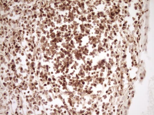 SAE1 Antibody (clone OTI6C7)