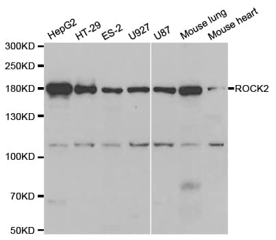 ROCK2 Antibody