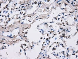 ATP5B / ATP Synthase Beta Antibody (clone OTI4E5)