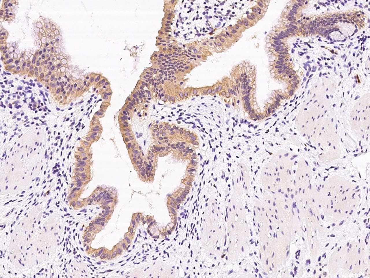 Polyclonal Rabbit anti-Human NRBP2 Antibody (IHC)