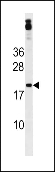 Polyclonal Rabbit anti-Human ZNF740 Antibody (aa37-65, WB)