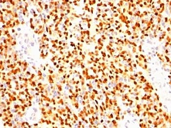 MYOG / Myogenin Antibody (clone SPM144)