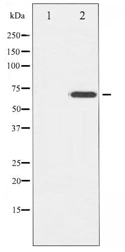 Polyclonal Rabbit anti-Human ZAP70 Antibody (phospho-Tyr319, WB)