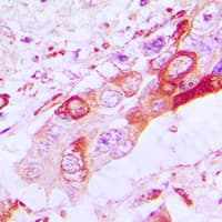 Polyclonal Rabbit anti-Human BAK1 / BAK Antibody (N-Terminus, IHC, WB)