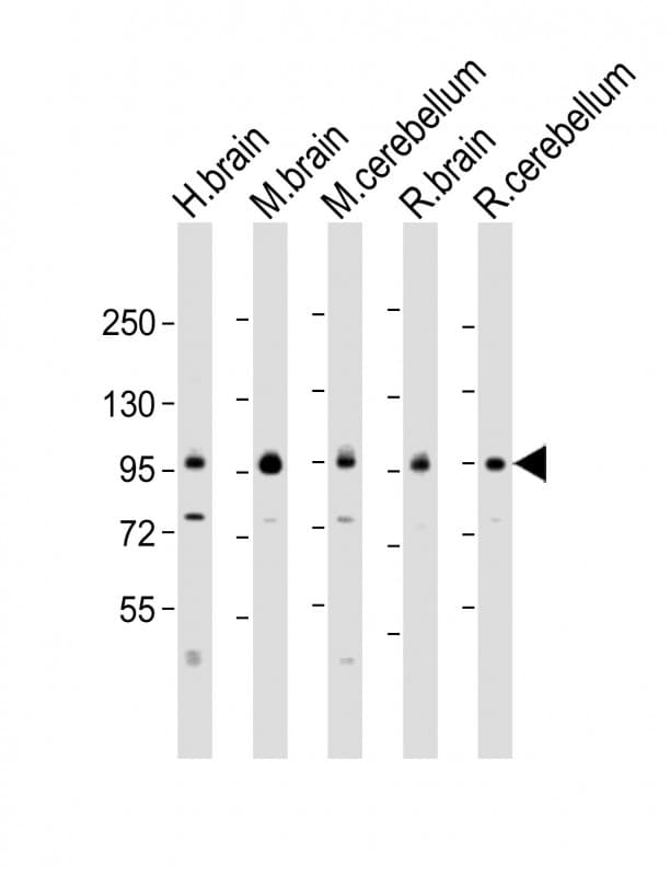 DLG4 / PSD95 Antibody (aa548-579)