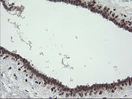TPD52L3 Antibody (clone OTI3D11, Carrier-free)